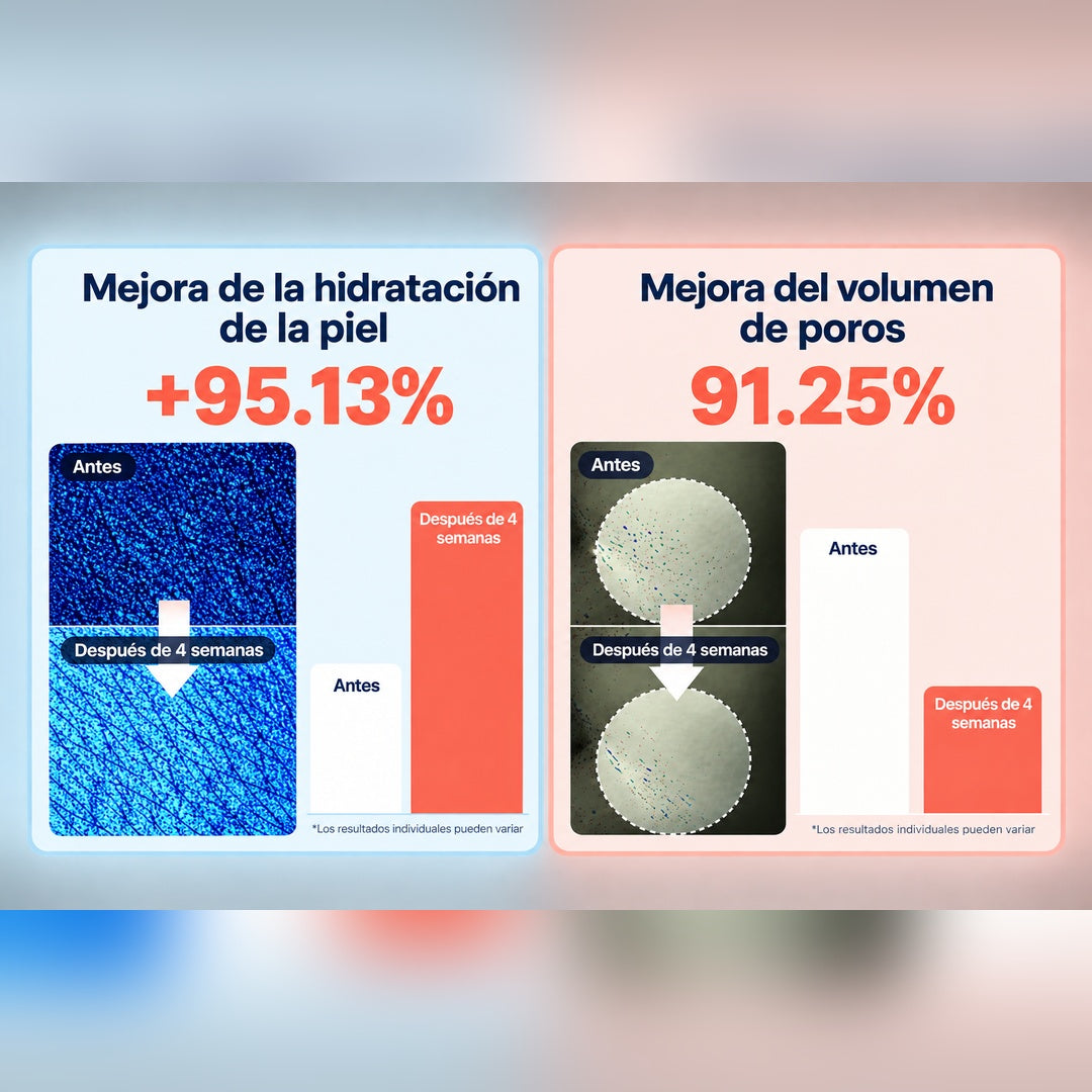 Infografía de resultados de Juvenil HidraColágeno tras 4 semanas: mejora de la hidratación de la piel del 95.13 % y reducción del volumen de poros del 91.25 %, con imágenes de la piel antes y después y gráficas comparativas. Los resultados individuales pueden variar.